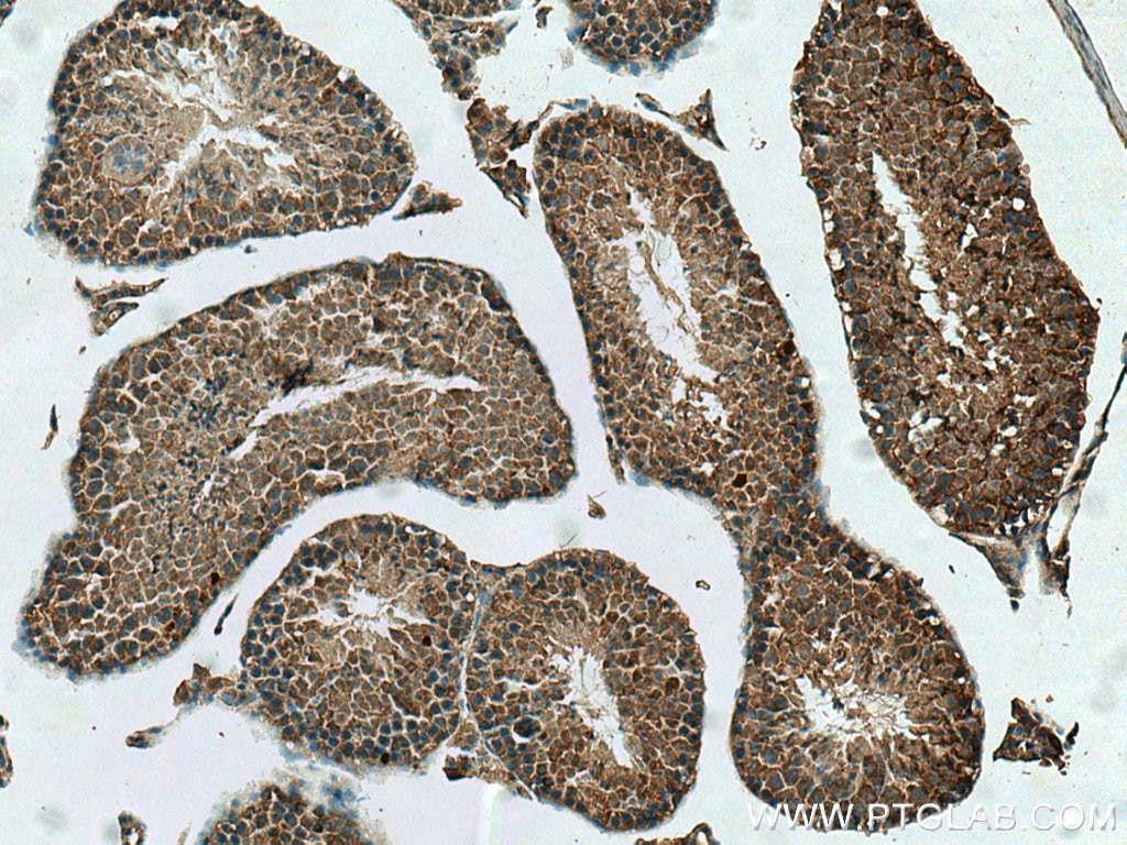 Immunohistochemistry (IHC) staining of mouse testis tissue using NUDT3/4/10/11 Polyclonal antibody (10912-1-AP)