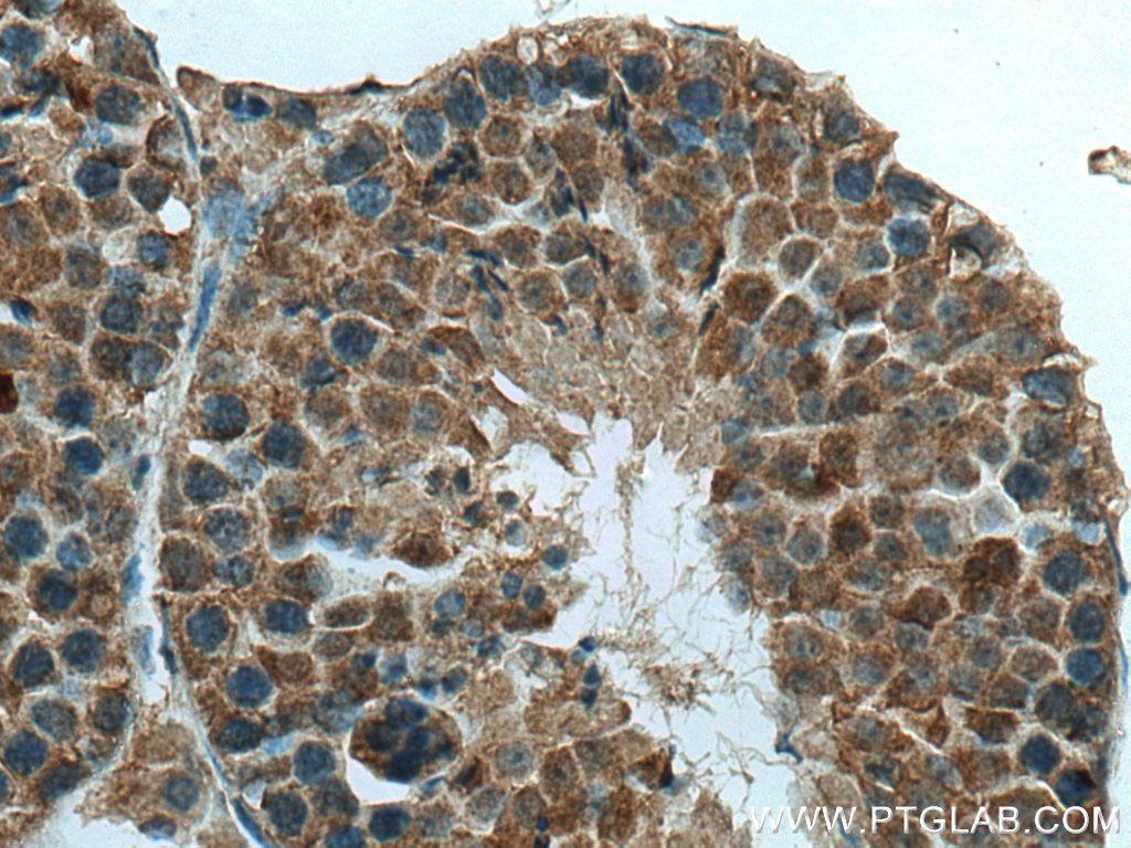 Immunohistochemistry (IHC) staining of mouse testis tissue using NUDT3/4/10/11 Polyclonal antibody (10912-1-AP)