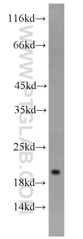 Western Blot (WB) analysis of mouse brain tissue using NUDT3/4/10/11 Polyclonal antibody (10912-1-AP)