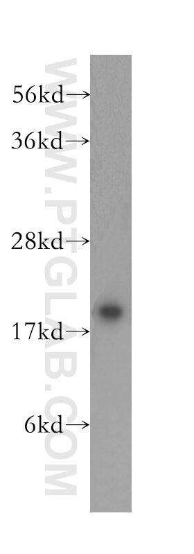 Western Blot (WB) analysis of human brain tissue using NUDT3/4/10/11 Polyclonal antibody (10912-1-AP)