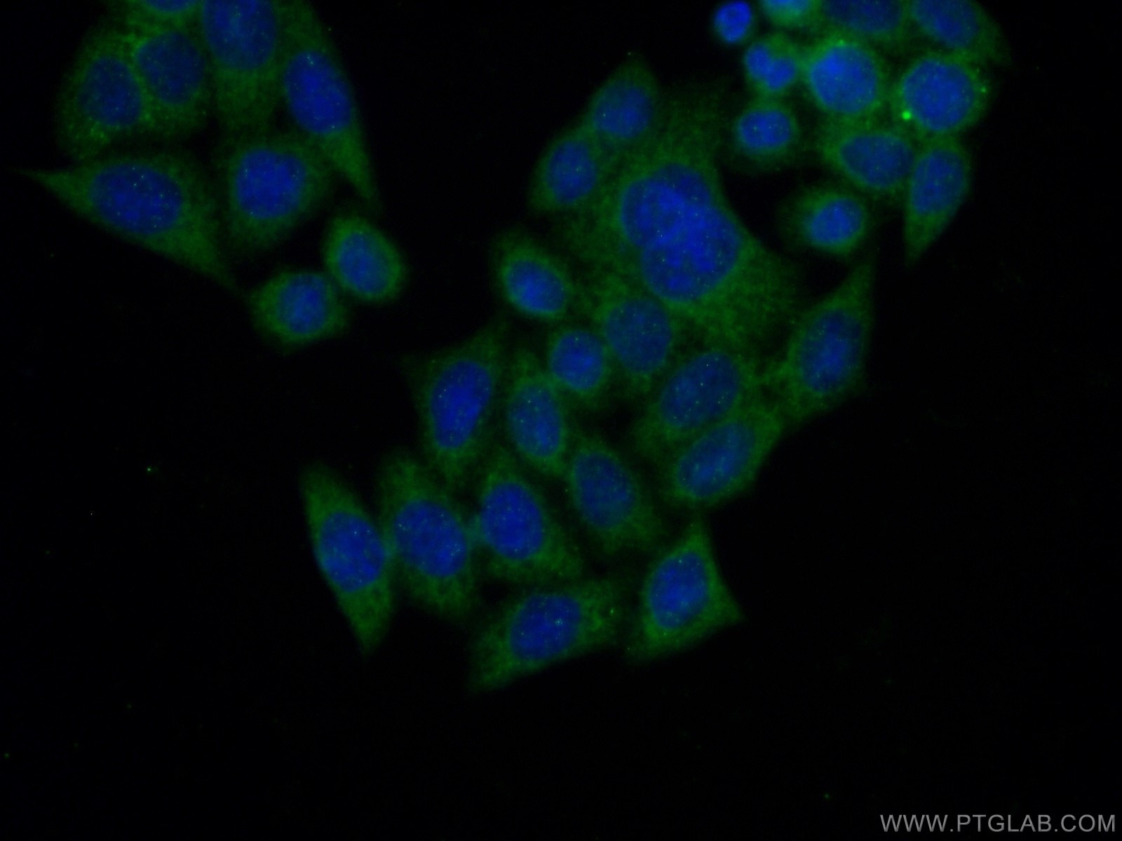 Immunofluorescence (IF) / fluorescent staining of HeLa cells using NUDT12 Polyclonal antibody (17487-1-AP)