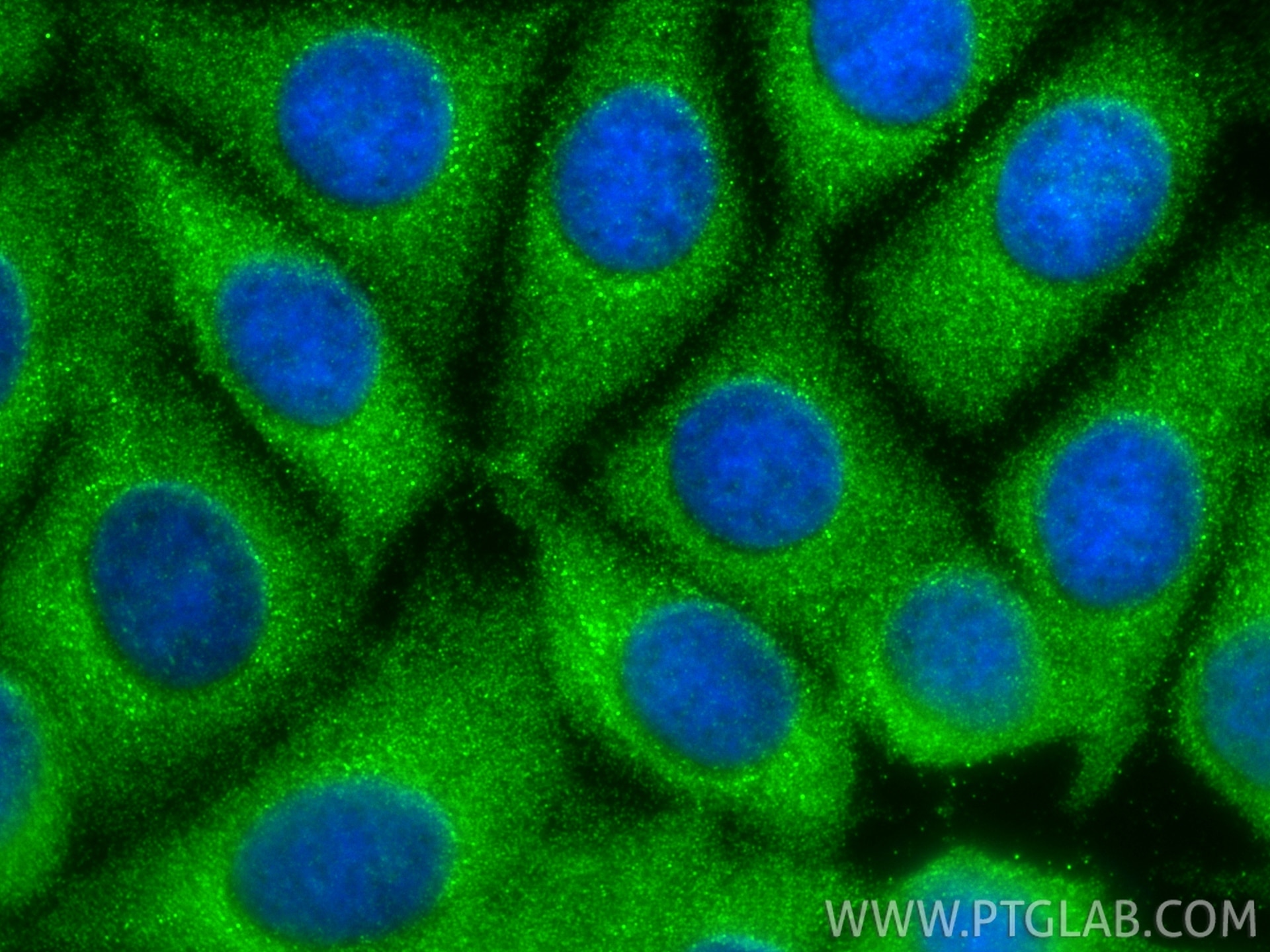 Immunofluorescence (IF) / fluorescent staining of MCF-7 cells using NUDT12 Polyclonal antibody (17487-1-AP)