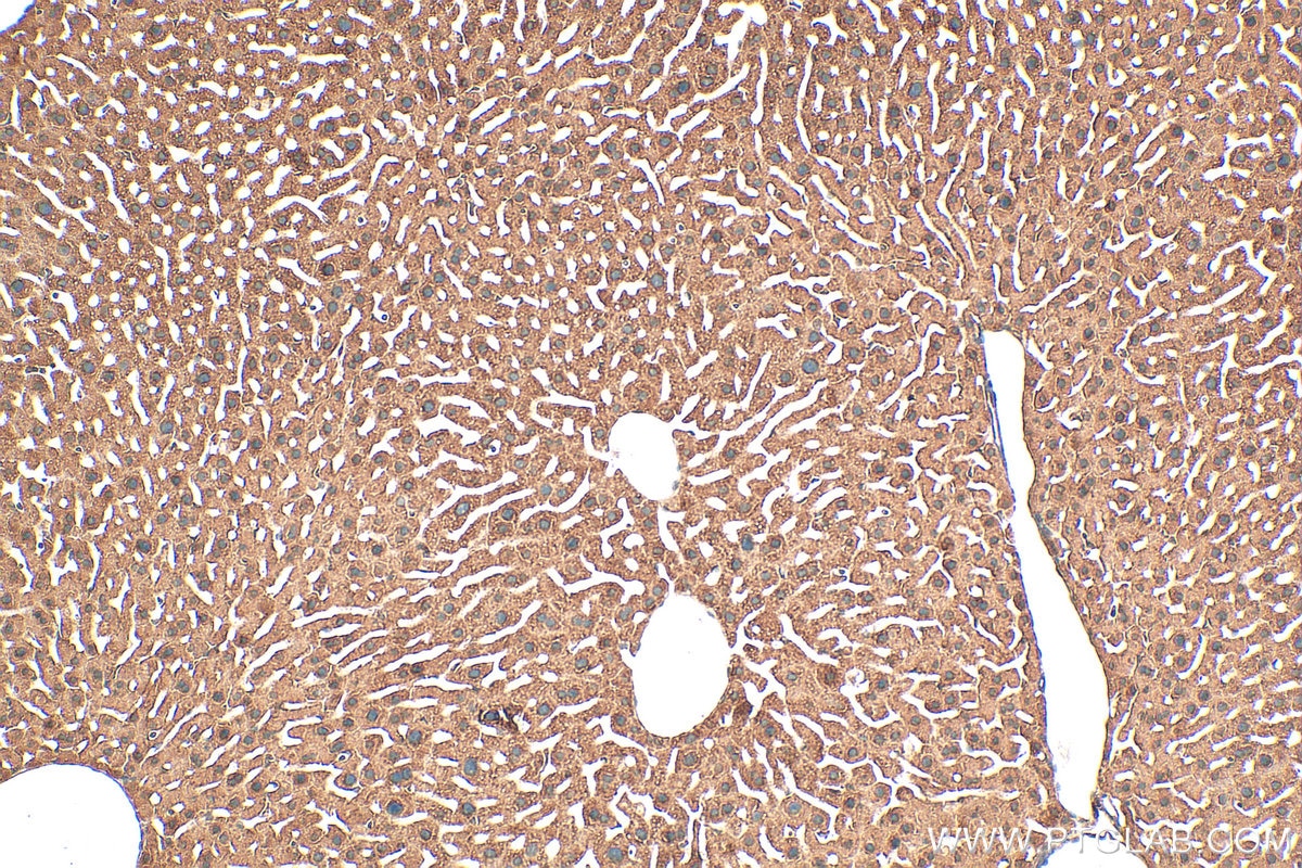 Immunohistochemistry (IHC) staining of mouse liver tissue using NUDT12 Polyclonal antibody (17487-1-AP)