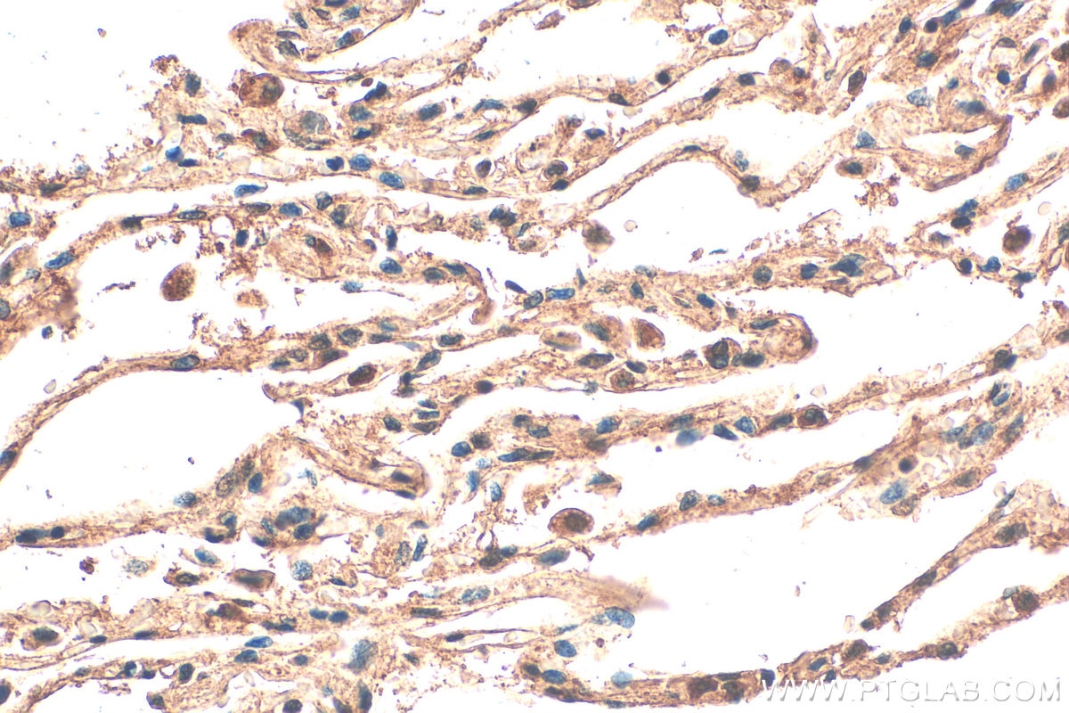Immunohistochemistry (IHC) staining of human lung tissue using NUDT12 Polyclonal antibody (17487-1-AP)