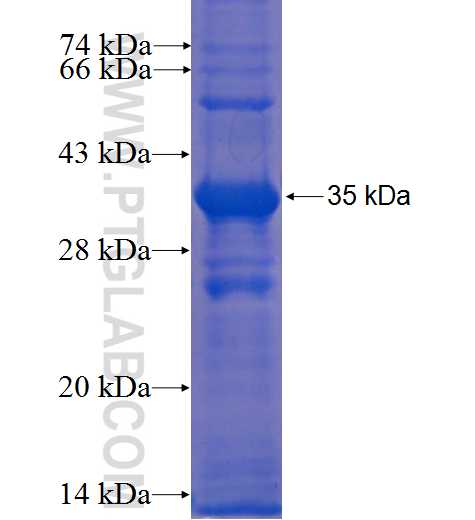NUDT13 fusion protein Ag23186 SDS-PAGE