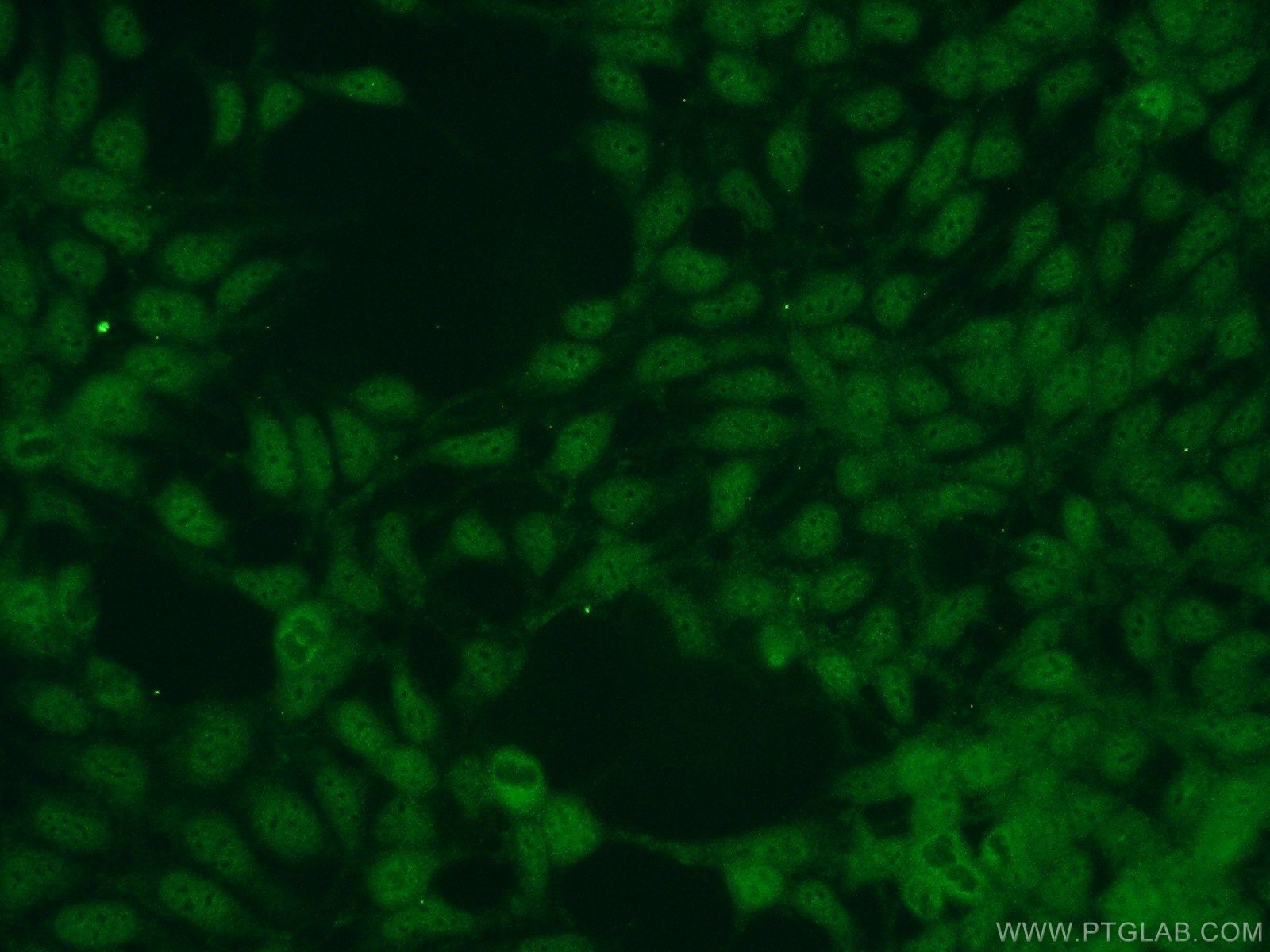 Immunofluorescence (IF) / fluorescent staining of HEK-293 cells using NUDT16 Polyclonal antibody (12889-1-AP)