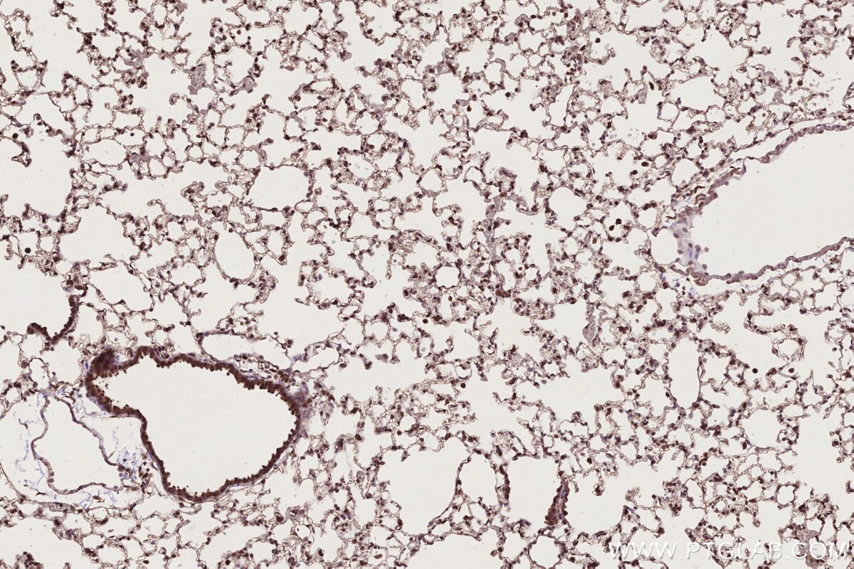 Immunohistochemistry (IHC) staining of mouse lung tissue using NUDT16 Polyclonal antibody (12889-1-AP)