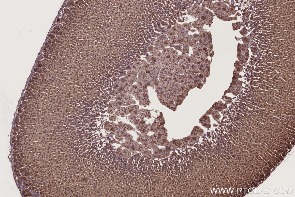 Immunohistochemistry (IHC) staining of mouse adrenal gland tissue using NUDT16 Polyclonal antibody (12889-1-AP)
