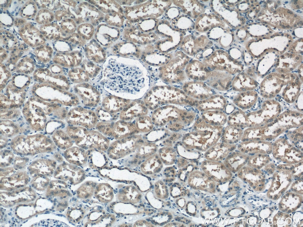 Immunohistochemistry (IHC) staining of human kidney tissue using NUDT16 Polyclonal antibody (12889-1-AP)