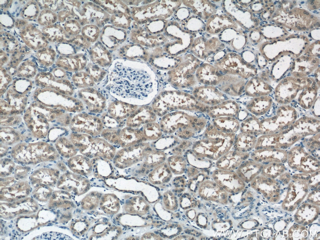 IHC staining of human kidney using 12889-1-AP