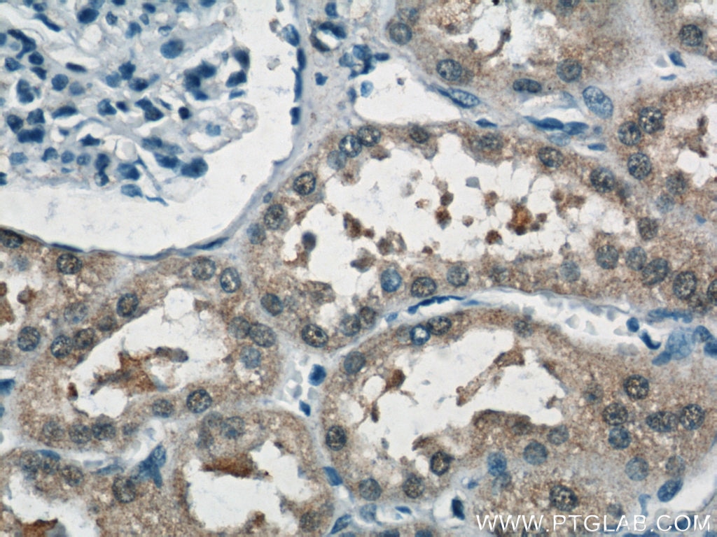 Immunohistochemistry (IHC) staining of human kidney tissue using NUDT16 Polyclonal antibody (12889-1-AP)
