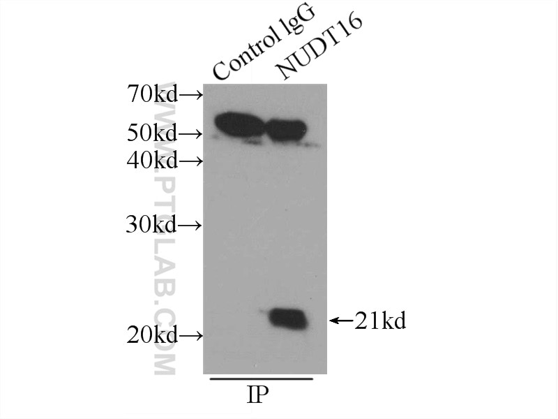 Immunoprecipitation (IP) experiment of HEK-293 cells using NUDT16 Polyclonal antibody (12889-1-AP)