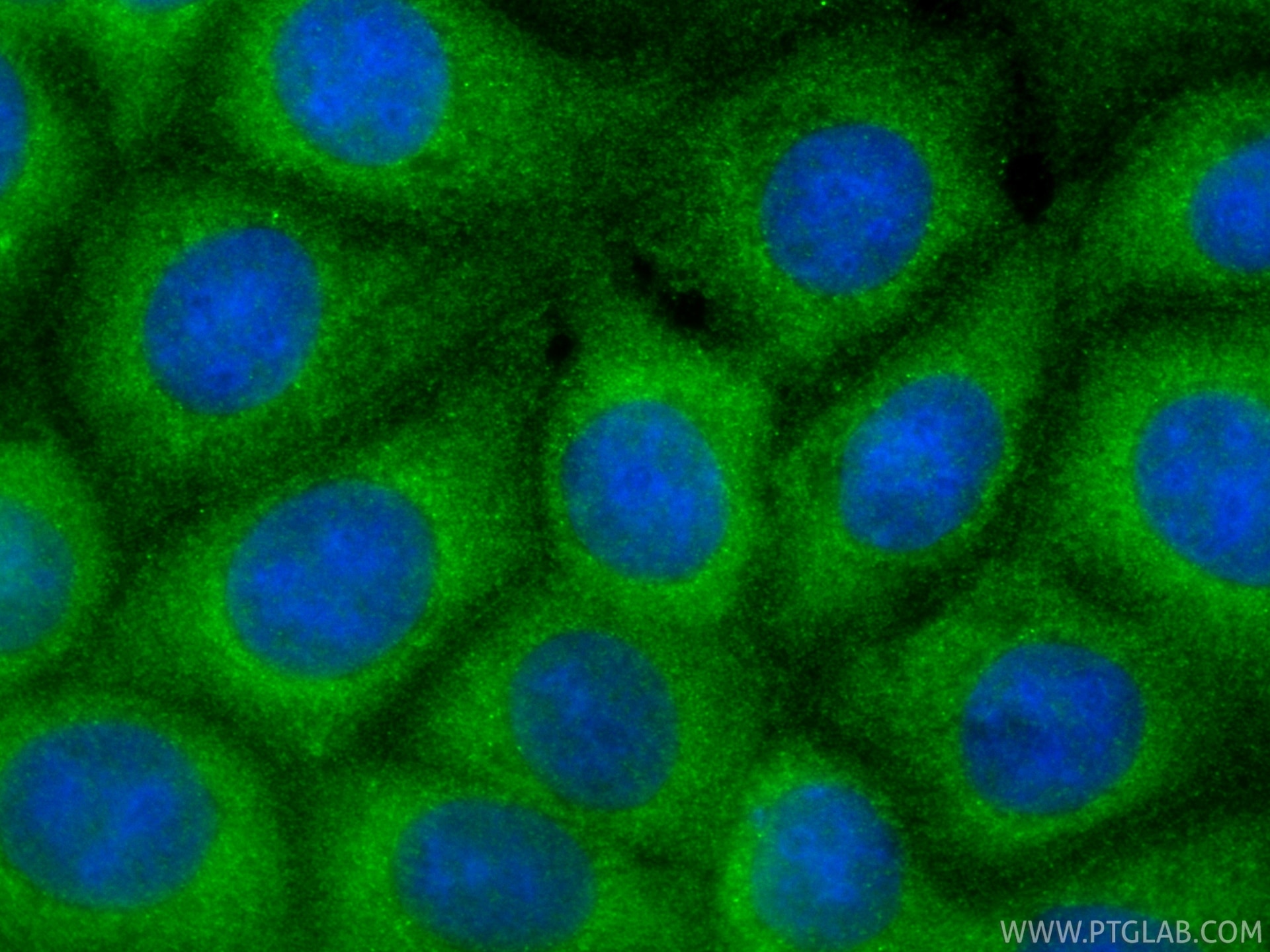 IF Staining of MCF-7 using 18805-1-AP Immunofluorescence (IF) / fluorescent staining of MCF-7 cells using NUDT17 Polyclonal antibody (18805-1-AP)