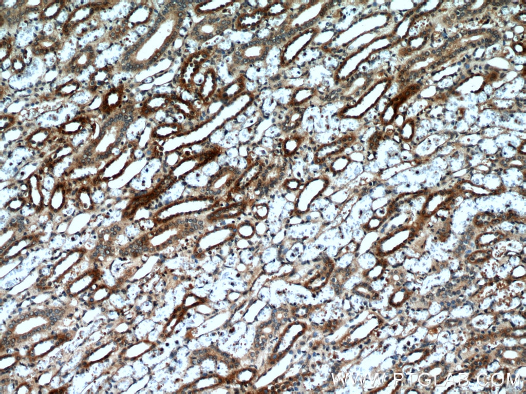 Immunohistochemistry (IHC) staining of human kidney tissue using NUDT19 Polyclonal antibody (55126-1-AP)
