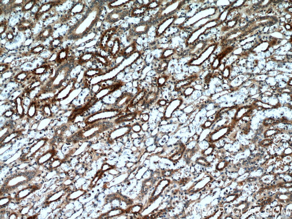 Immunohistochemistry (IHC) staining of human kidney tissue using NUDT19 Polyclonal antibody (55126-1-AP)
