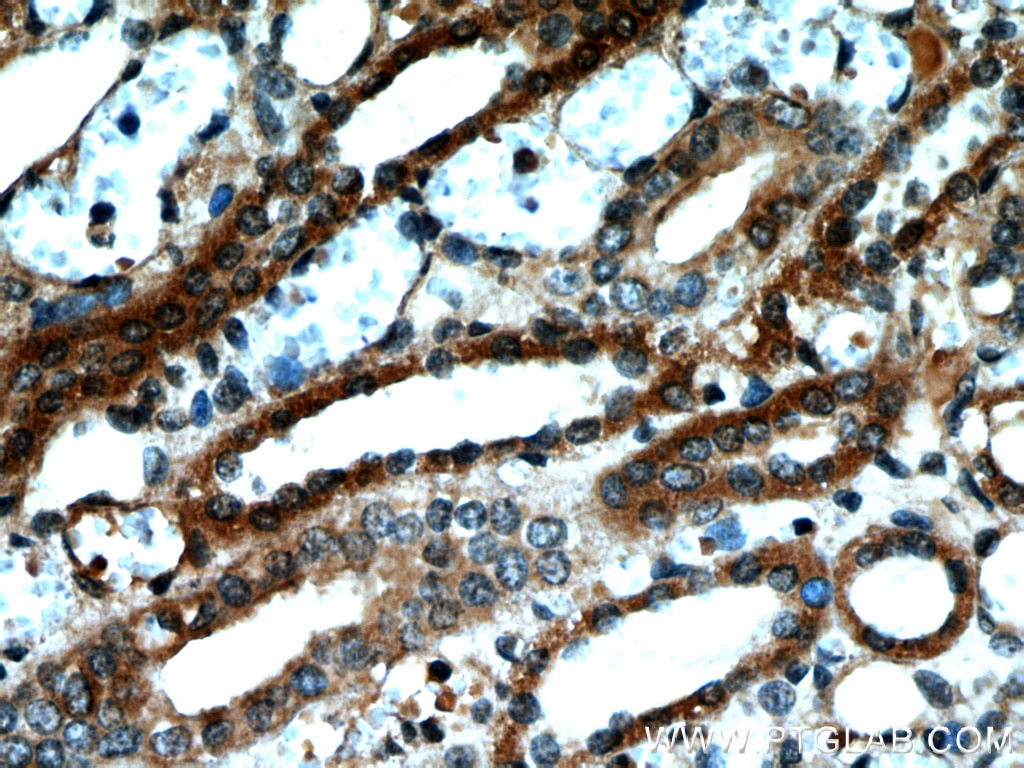 Immunohistochemistry (IHC) staining of human kidney tissue using NUDT19 Polyclonal antibody (55126-1-AP)