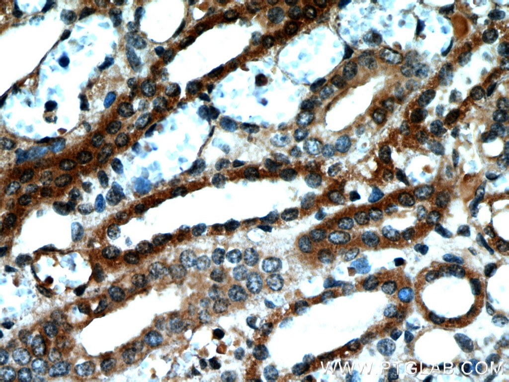 IHC staining of human kidney using 55126-1-AP