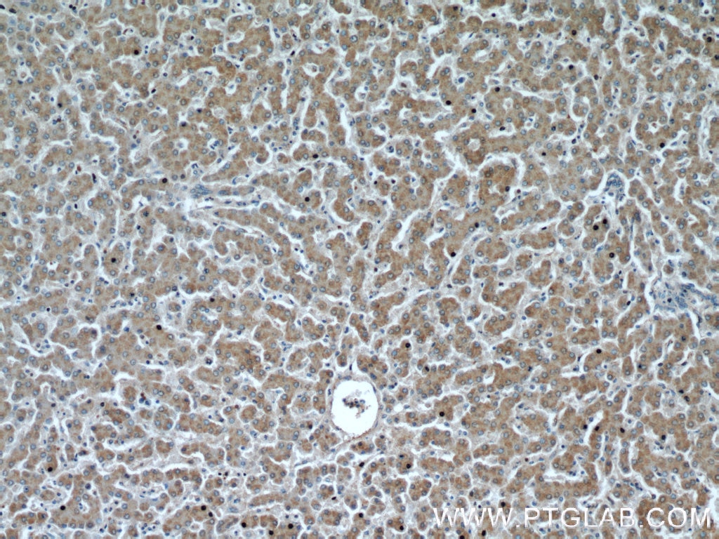 Immunohistochemistry (IHC) staining of human liver tissue using NUDT19 Polyclonal antibody (55126-1-AP)