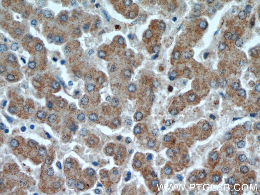 Immunohistochemistry (IHC) staining of human liver tissue using NUDT19 Polyclonal antibody (55126-1-AP)