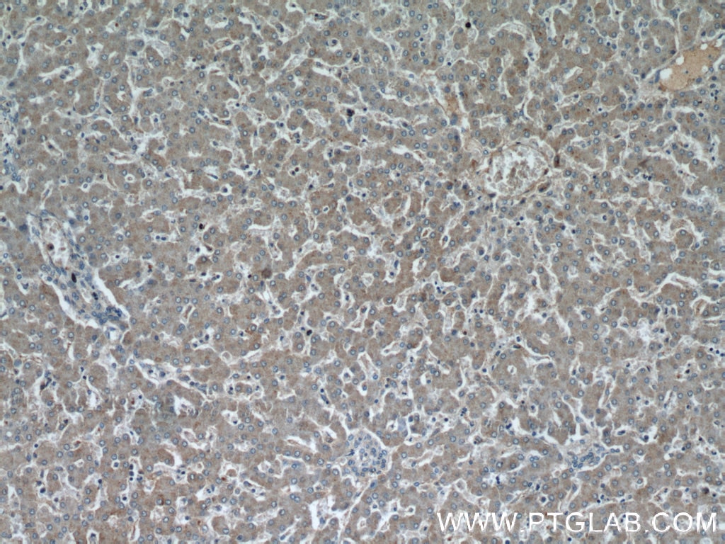 Immunohistochemistry (IHC) staining of human liver tissue using NUDT19 Polyclonal antibody (55126-1-AP)