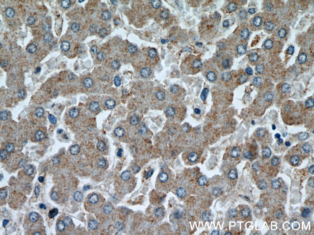 Immunohistochemistry (IHC) staining of human liver tissue using NUDT19 Polyclonal antibody (55126-1-AP)