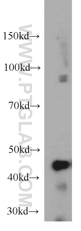 Western Blot (WB) analysis of HEK-293 cells using NUDT19 Polyclonal antibody (55126-1-AP)
