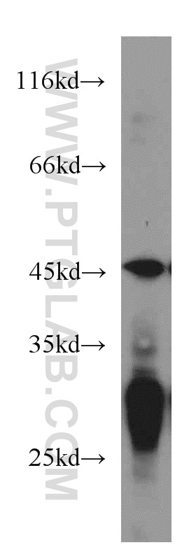 Western Blot (WB) analysis of HEK-293 cells using NUDT19 Polyclonal antibody (55126-1-AP)