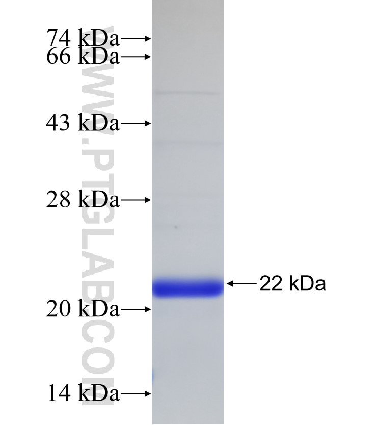 NUDT2 fusion protein Ag33167 SDS-PAGE NUDT2 fusion protein Ag33167 SDS-PAGE