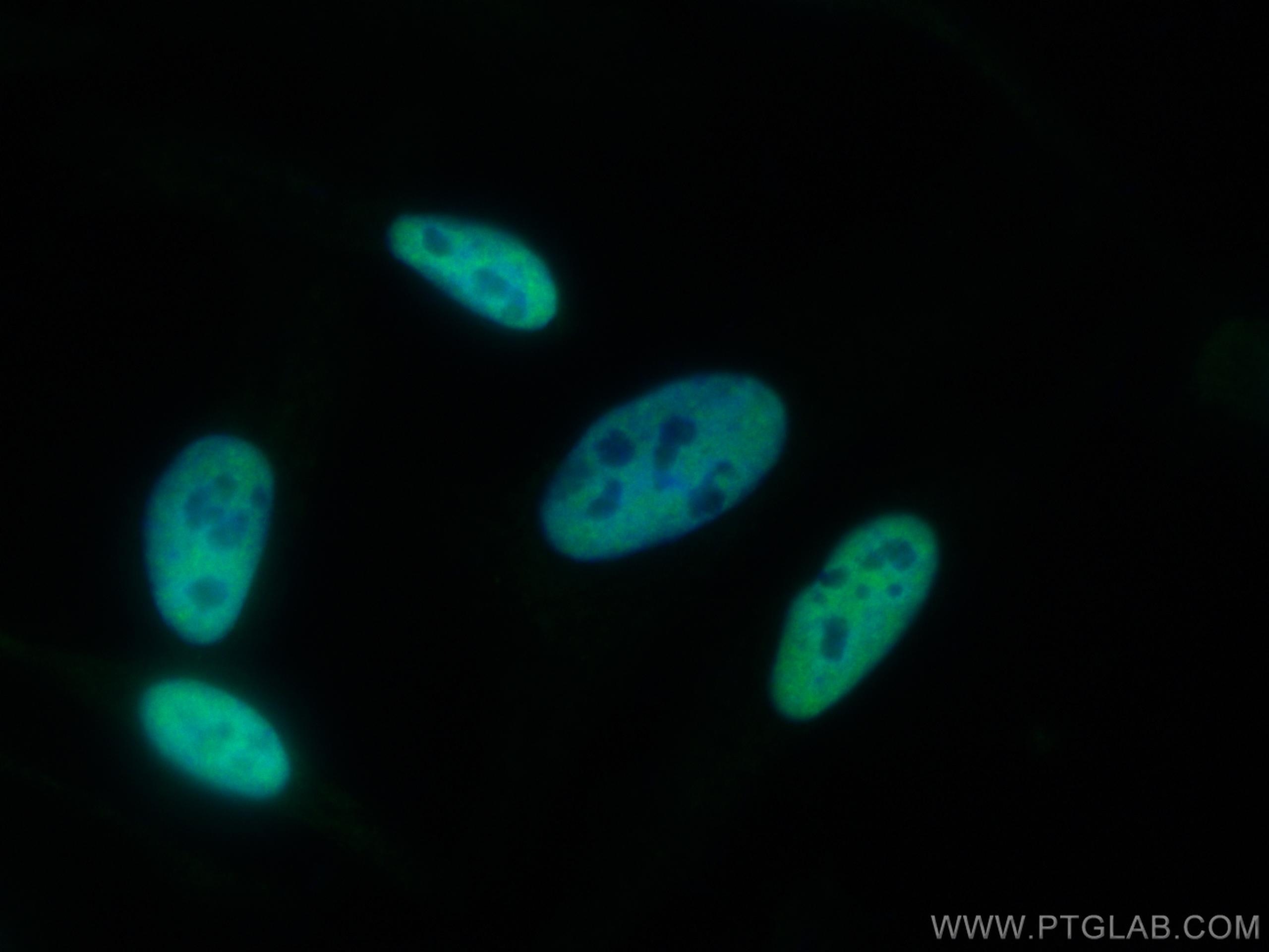 Immunofluorescence (IF) / fluorescent staining of HeLa cells using NUDT21 Polyclonal antibody (10322-1-AP)