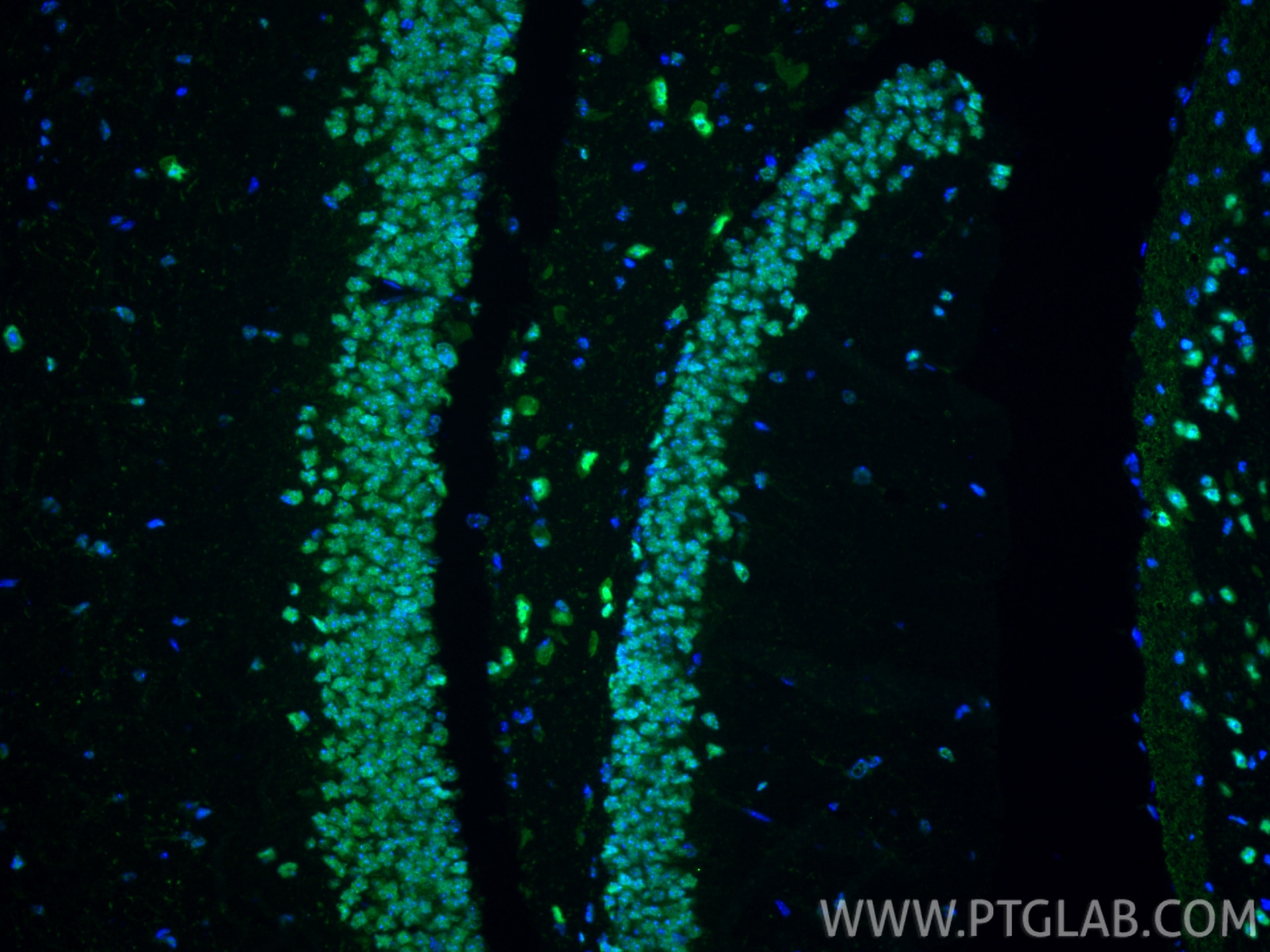 Immunofluorescence (IF) / fluorescent staining of mouse brain tissue using NUDT21 Polyclonal antibody (10322-1-AP)
