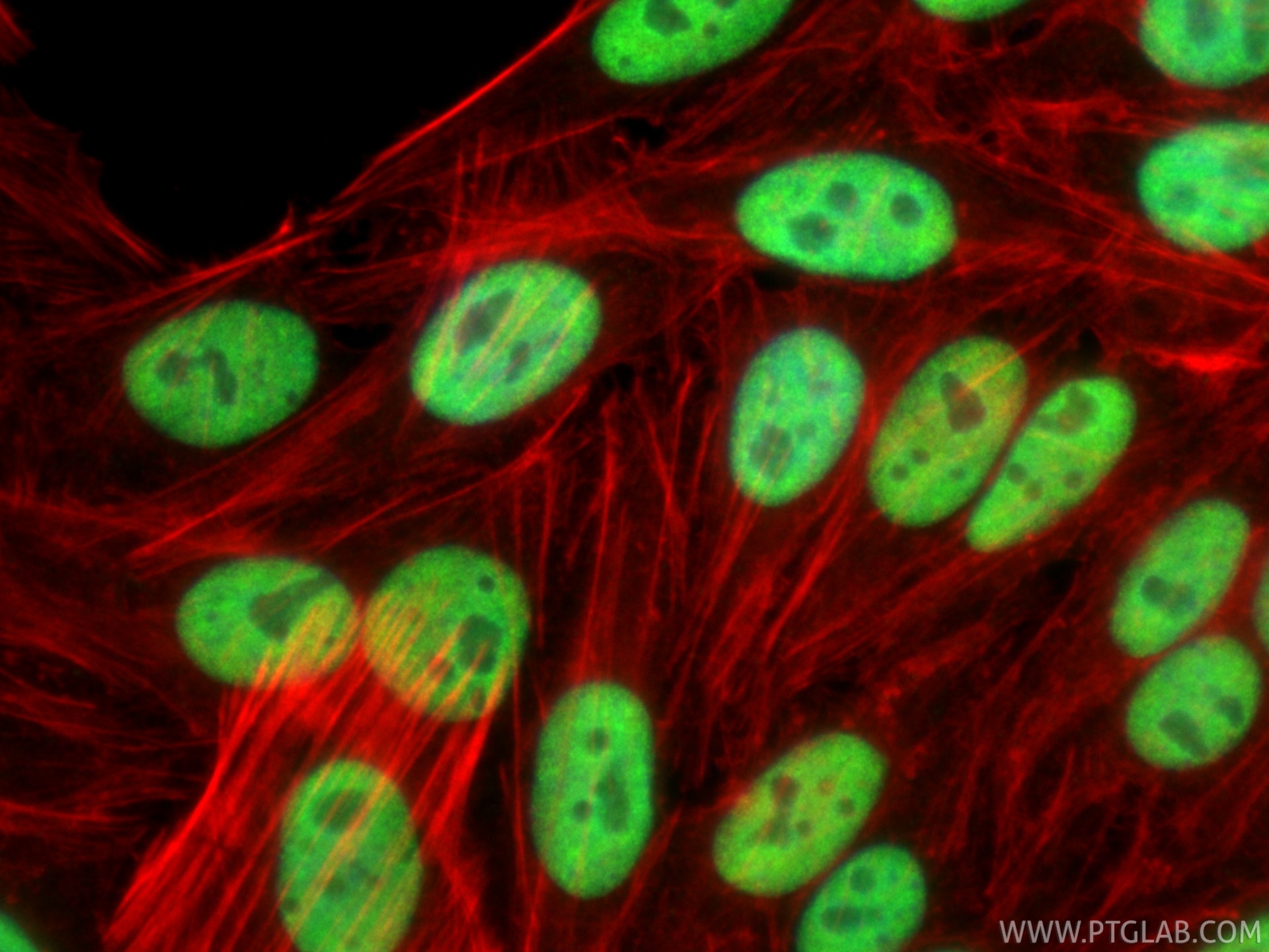 Immunofluorescence (IF) / fluorescent staining of HepG2 cells using NUDT21 Polyclonal antibody (10322-1-AP)