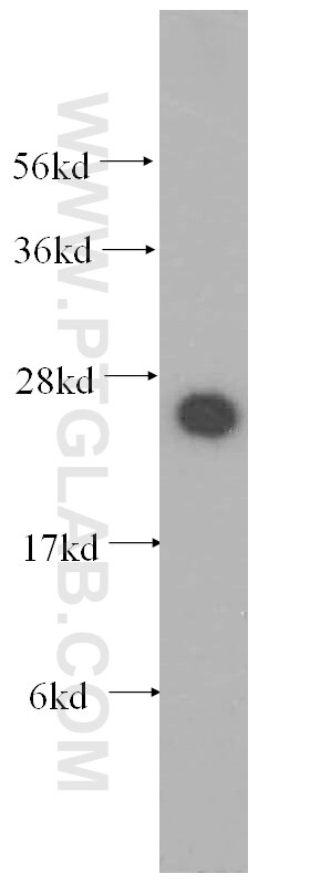 NUDT21 Polyclonal antibody