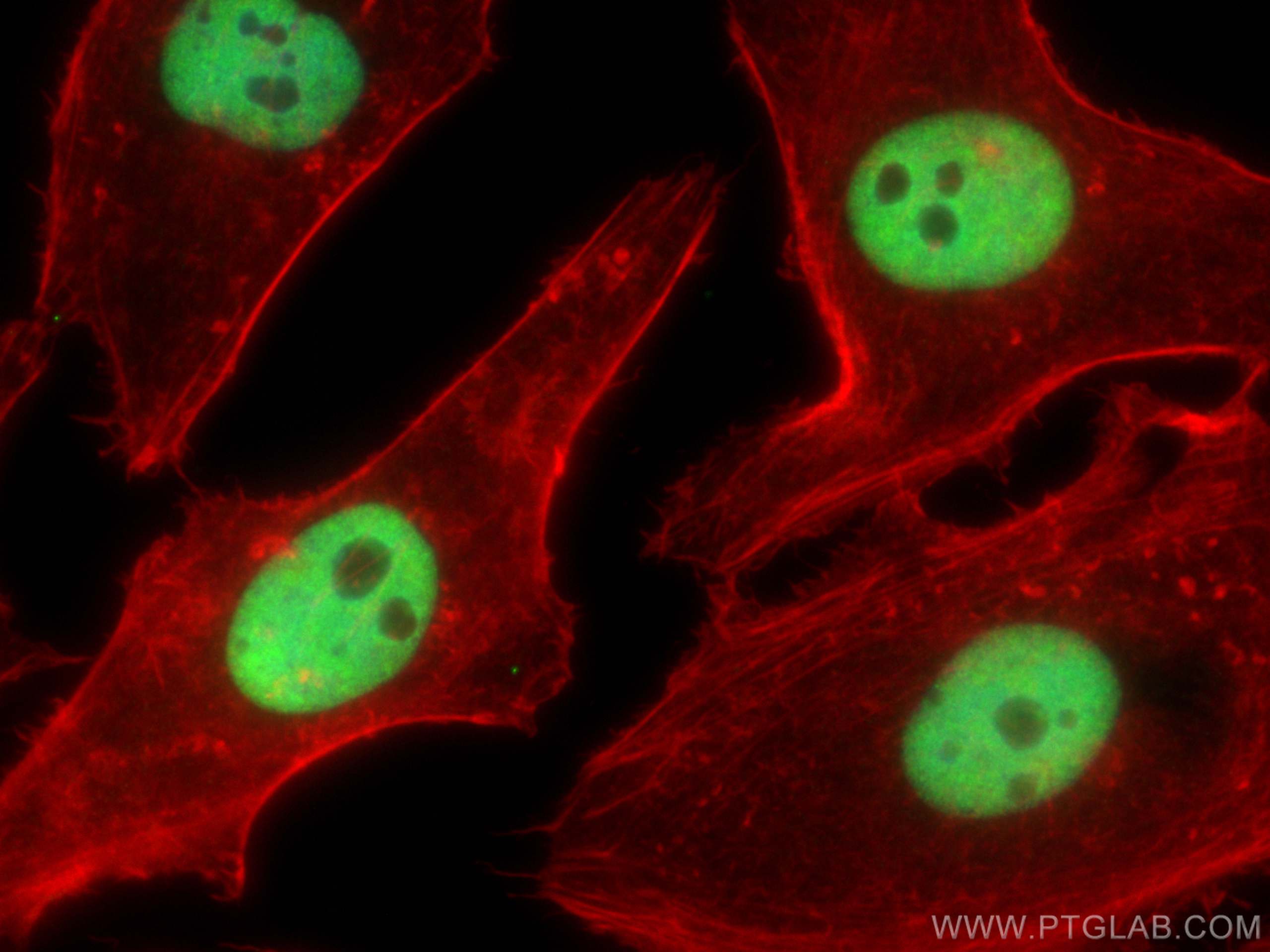Immunofluorescence (IF) / fluorescent staining of HeLa cells using NUDT21 Monoclonal antibody (66335-1-Ig)