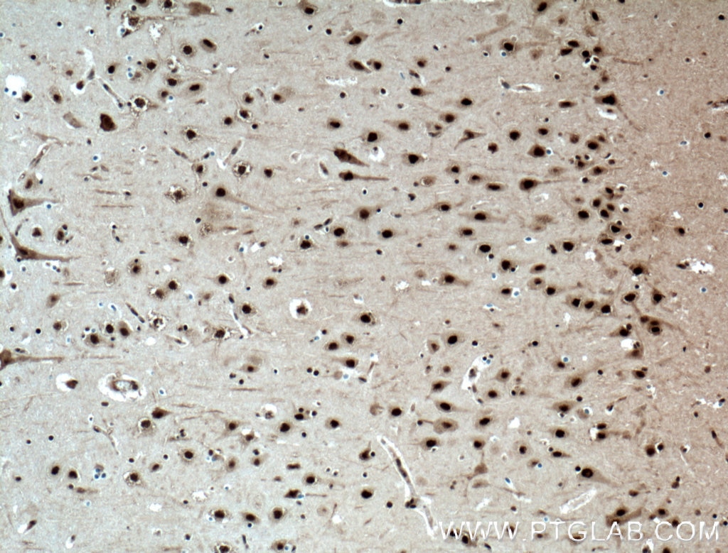 Immunohistochemistry (IHC) staining of human brain tissue using NUDT21 Monoclonal antibody (66335-1-Ig)