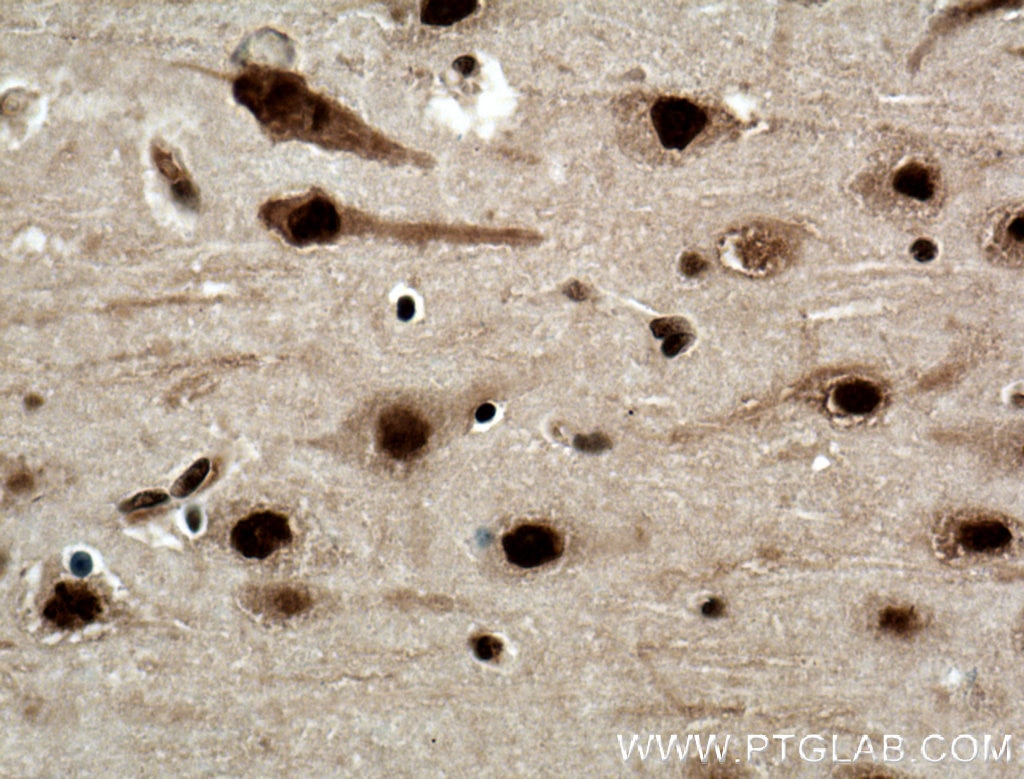 IHC staining of human brain using 66335-1-Ig