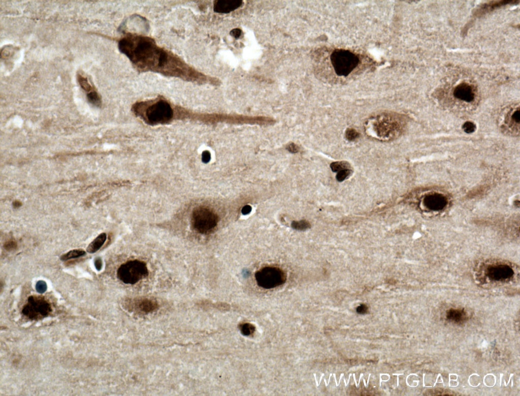 Immunohistochemistry (IHC) staining of human brain tissue using NUDT21 Monoclonal antibody (66335-1-Ig)