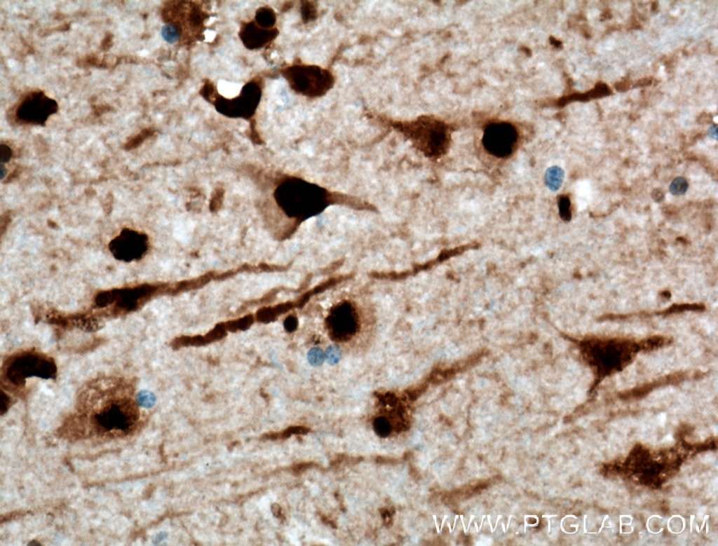 IHC staining of human brain using 66335-1-Ig