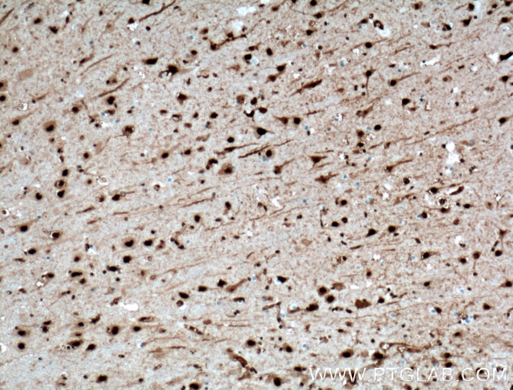 IHC staining of human brain using 66335-1-Ig