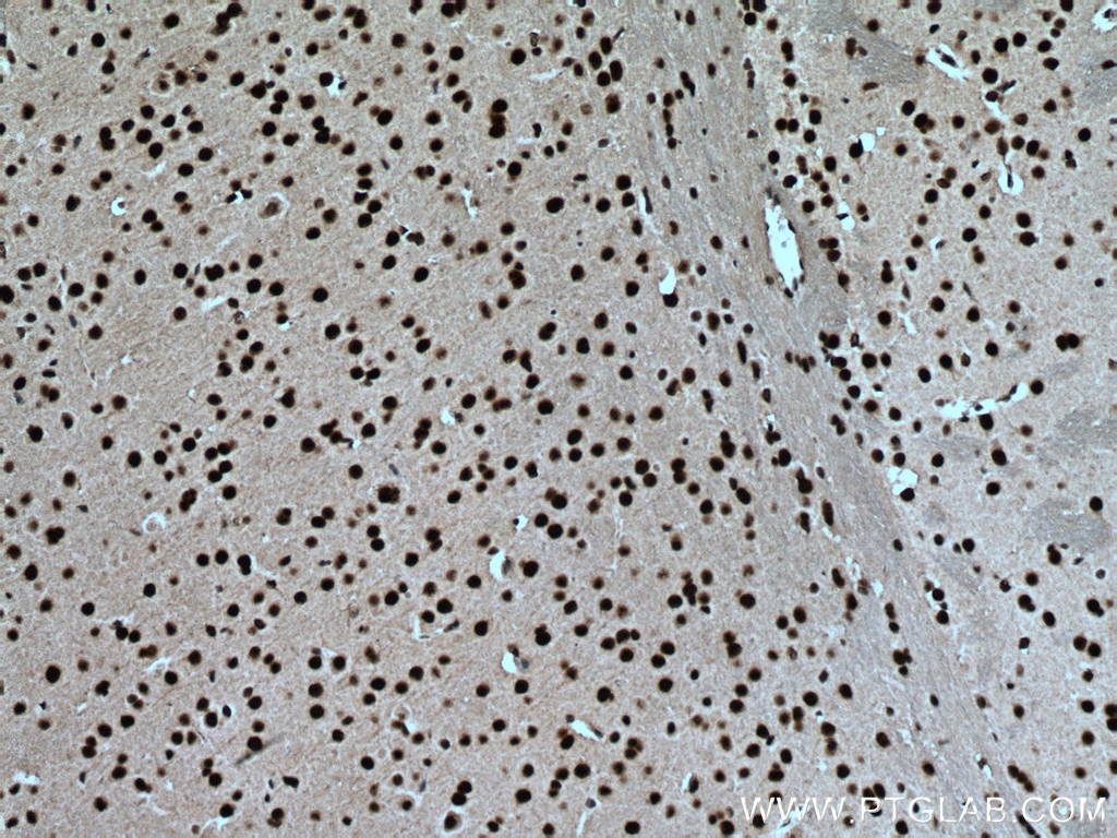 IHC staining of mouse brain using 66335-1-Ig