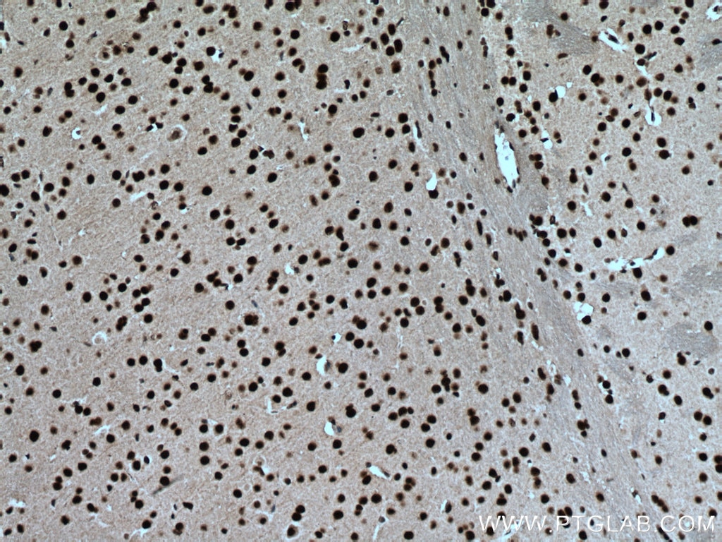 Immunohistochemistry (IHC) staining of mouse brain tissue using NUDT21 Monoclonal antibody (66335-1-Ig)