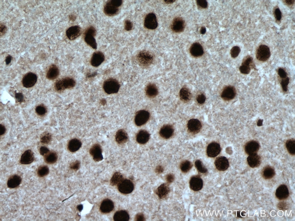 Immunohistochemistry (IHC) staining of mouse brain tissue using NUDT21 Monoclonal antibody (66335-1-Ig)