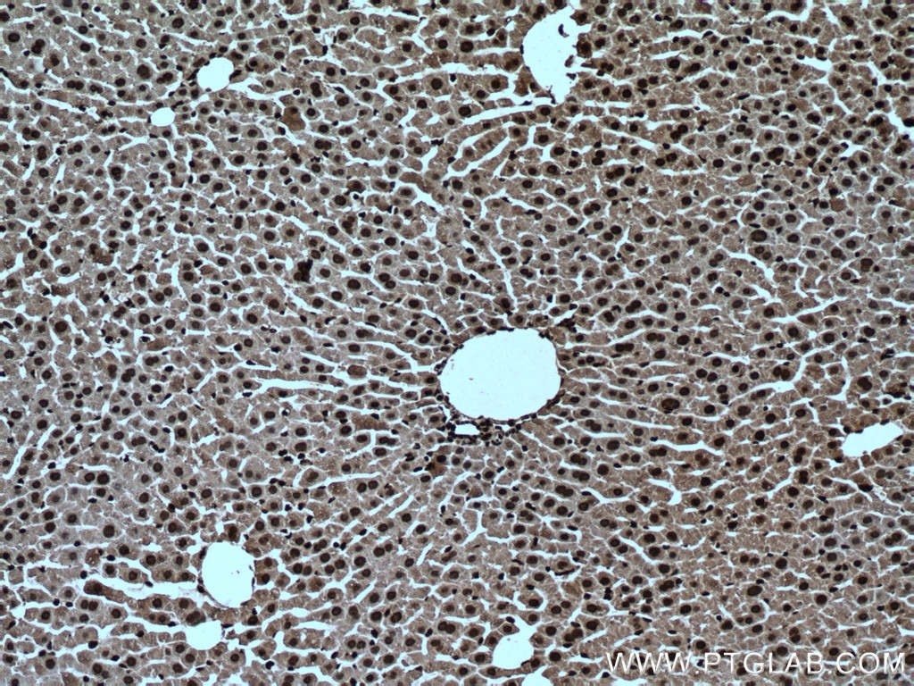 IHC staining of mouse liver using 66335-1-Ig