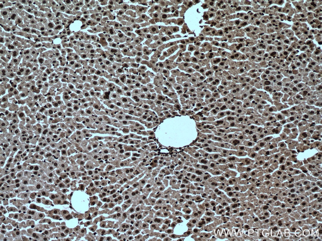 Immunohistochemistry (IHC) staining of mouse liver tissue using NUDT21 Monoclonal antibody (66335-1-Ig)