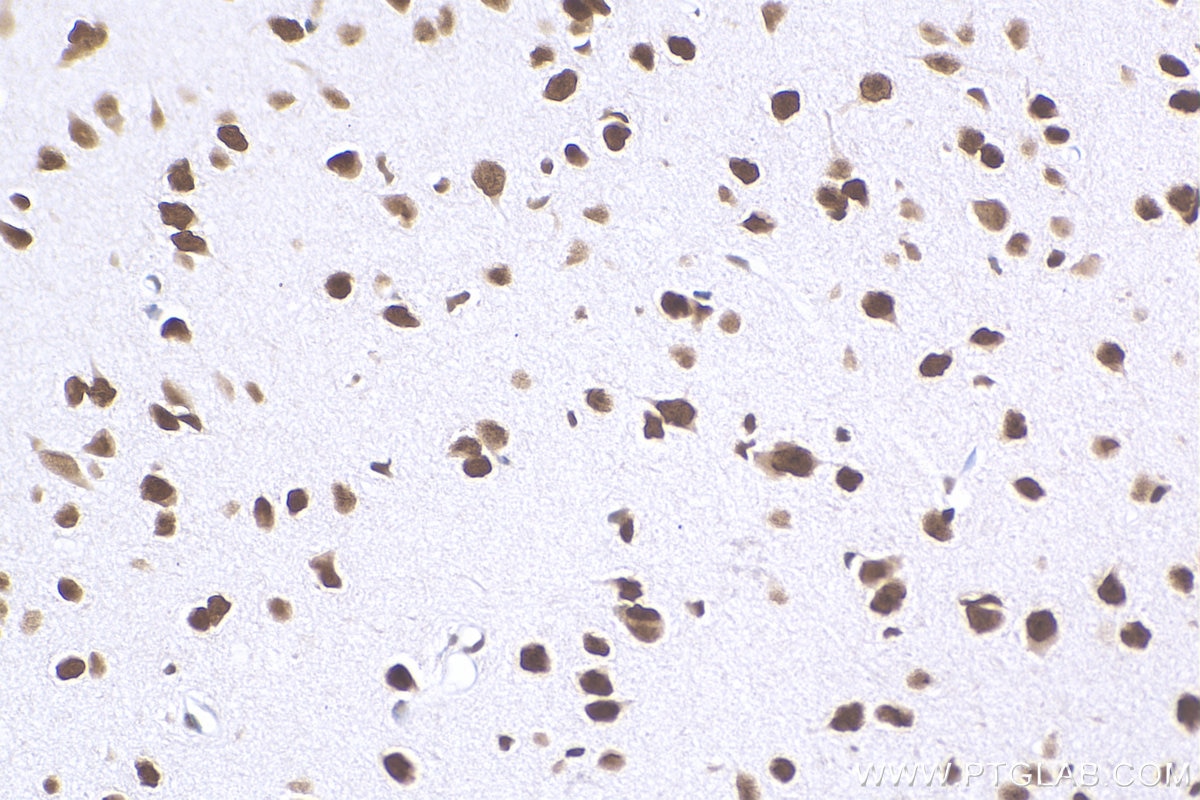 Immunohistochemistry (IHC) staining of mouse brain tissue using NUDT21 Monoclonal antibody (66335-1-Ig)
