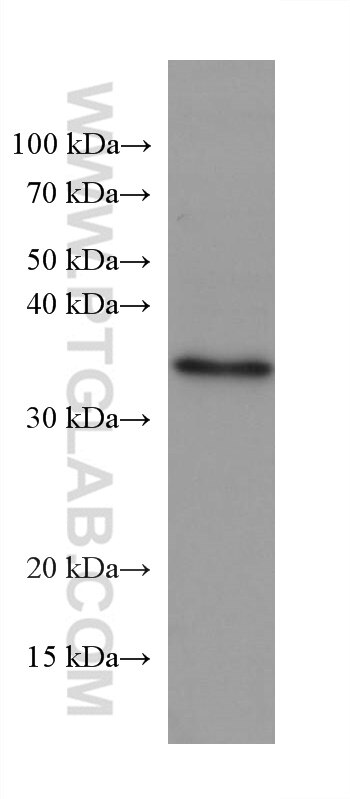 Western Blot (WB) analysis of LNCaP cells using NUDT22 Monoclonal antibody (67921-1-Ig)