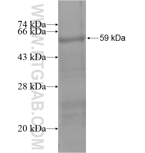 NUDT22 fusion protein Ag14711 SDS-PAGE