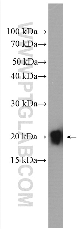 Western Blot (WB) analysis of mouse brain tissue using NUDT3/4/10/11 Polyclonal antibody (20542-1-AP)