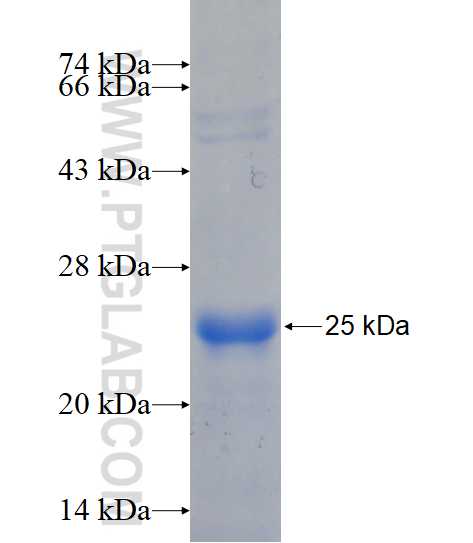 NUDT3 fusion protein Ag15163 SDS-PAGE