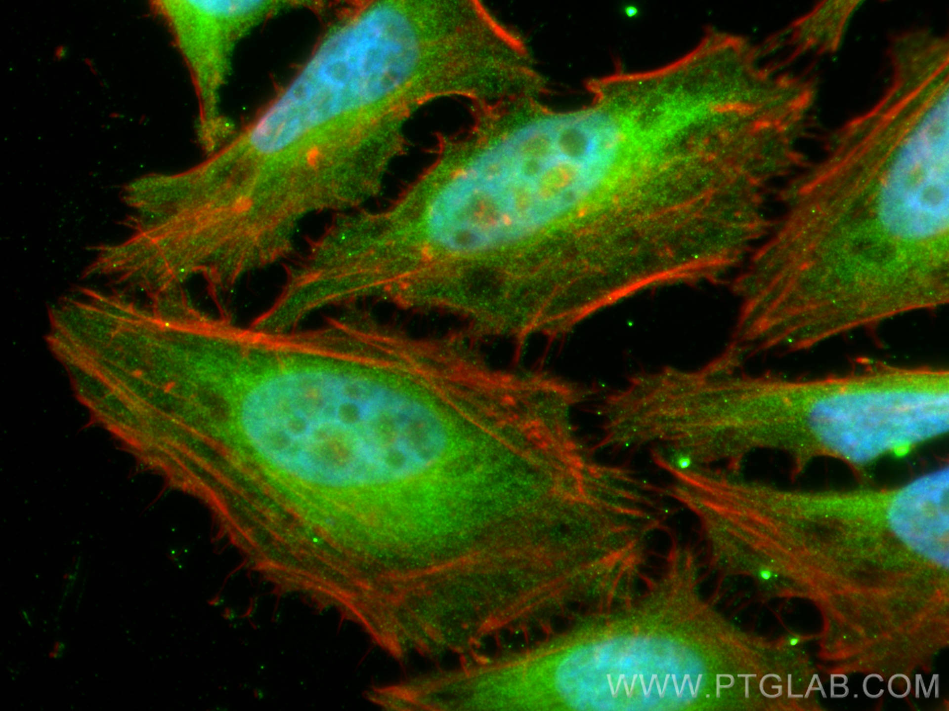 Immunofluorescence (IF) / fluorescent staining of HeLa cells using NUDT5 Polyclonal antibody (27004-1-AP)