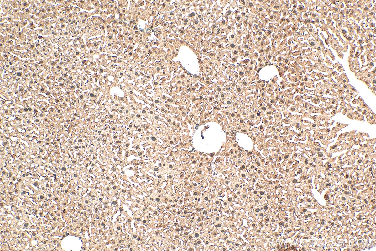 Immunohistochemistry (IHC) staining of mouse liver tissue using NUDT5 Polyclonal antibody (27004-1-AP)